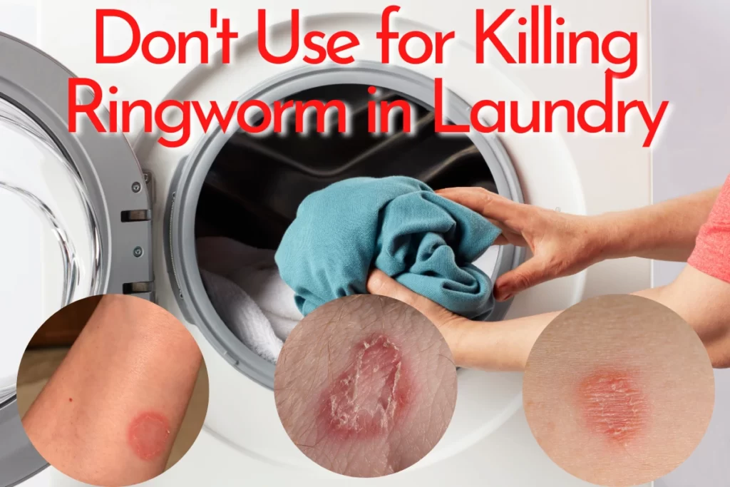 killing ringworm in laundry