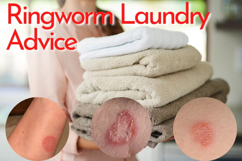 ringworm laundry advice