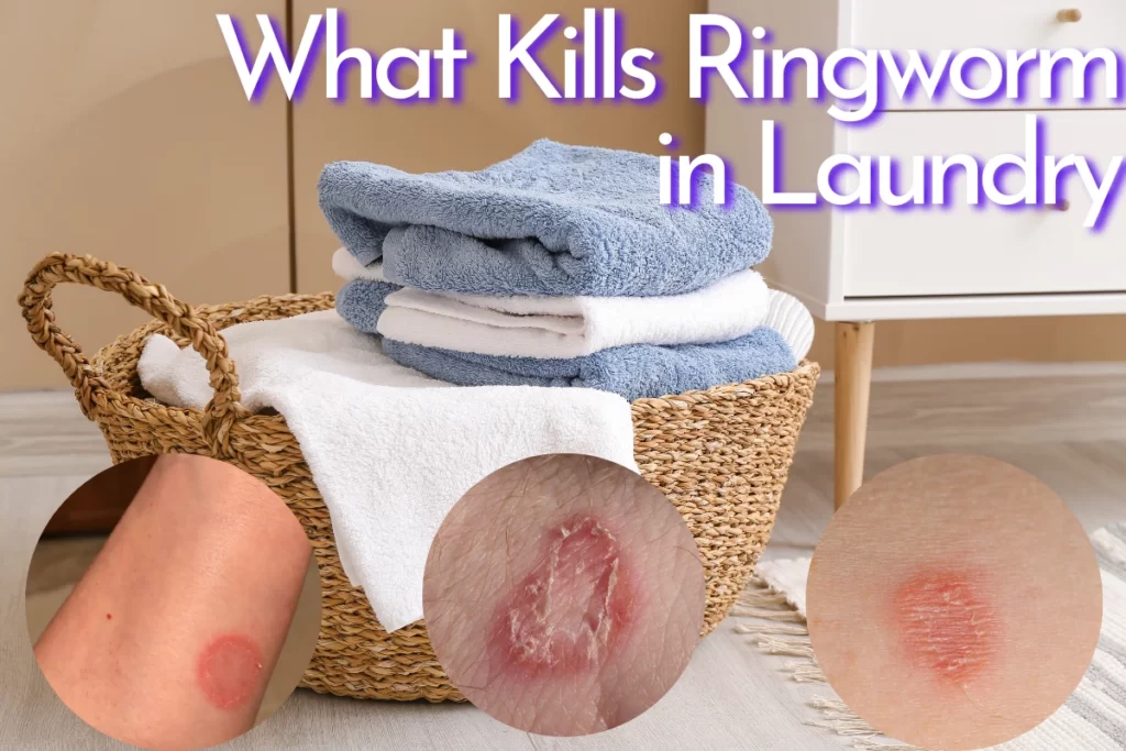 what kills ringworm in laundry